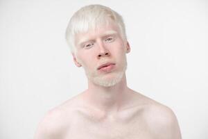 retrato de un albino hombre en estudio vestido camiseta aislado en un blanco antecedentes. anormal desviaciones raro apariencia foto