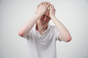 albinismo albino hombre en estudio vestido camiseta aislado en un blanco antecedentes. anormal desviaciones raro apariencia foto