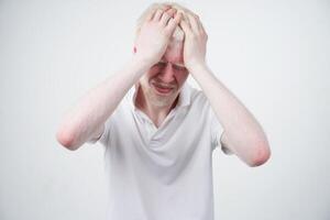 retrato de un albino hombre en estudio vestido camiseta aislado en un blanco antecedentes. anormal desviaciones raro apariencia foto