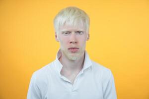 albinism albino man in studio dressed t-shirt isolated on a yellow background. abnormal deviations. unusual appearance photo