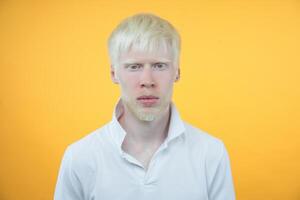 albinismo albino hombre en estudio vestido camiseta aislado en un amarillo antecedentes. anormal desviaciones raro apariencia foto