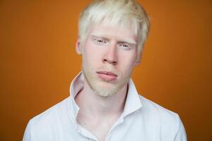 albinismo albino hombre en estudio vestido camiseta aislado en un amarillo antecedentes. anormal desviaciones raro apariencia foto