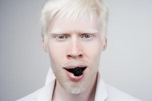 albinism albino man in studio dressed t-shirt isolated on a white background. abnormal deviations. unusual appearance photo