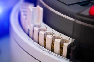 Examining urine in laboratory, closeup. Tubes with urine. Prevention. Health care. Virus identification. photo