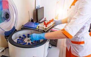 Blood samples for research in microtubes. Testing in laboratory. Centrifuge for blood analyzing. Chemical research. Prevention. Pneumonia diagnosing. COVID-19 and coronavirus identification. Pandemic. photo