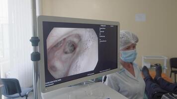 Oekraïne. lviv 10.05.2022 long endoscopie. artsen toezicht houden op de longen met een endosop. een kijken Bij de toezicht houden op scherm Aan de patiënten longen. video