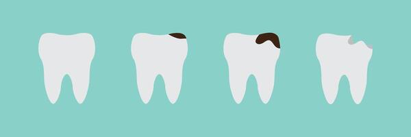 Teeth on different stages of caries. Tooth decay, toothache. Deep caries and pulpits. Flat style vector illustration isolated