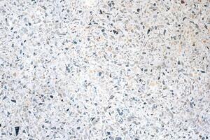 Terrazzo, Versatile Stone Texture for Stylish Backgrounds on Floors and Walls. photo