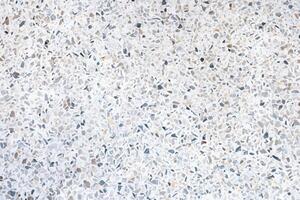 Terrazzo, Versatile Stone Texture for Stylish Backgrounds on Floors and Walls. photo