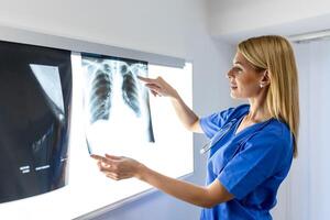 radiology and medicine concept. doctor explaining the results of scan lung on screen to senior patient. photo