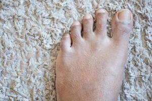 close up of young man dry feet on floor photo