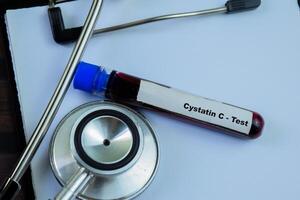 Cystatin C - Test with blood sample on wooden background. Healthcare or medical concept photo