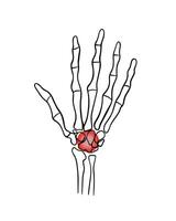 isolated illustration of wrist pain. Hand with localization of pain in the wrist. vector