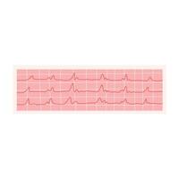 ECG illustration. Electrocardiogram isolated on a white background. vector