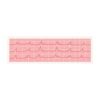 ECG illustration. Electrocardiogram isolated on a white background. vector