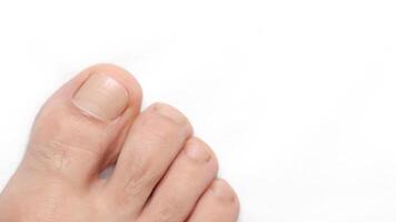 Closeup of a toe with white background and space for text on the right photo