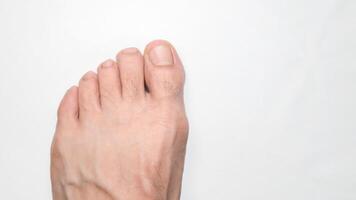 Close up of a person left foot toes with white background and space on the right for text photo