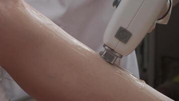 Leg laser epilation procedure video