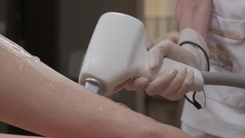 Bein Laser- Epilation Verfahren video