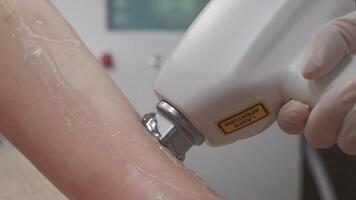 Leg laser epilation procedure video