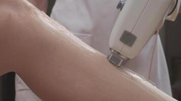 Leg laser epilation procedure video