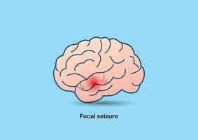 Illustration of brain and abnormal brain waves vector