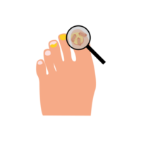 Onychomycosis. Feet with nail disease. Fungal nails infection. Doctors exam, treat nails psoriasis. png