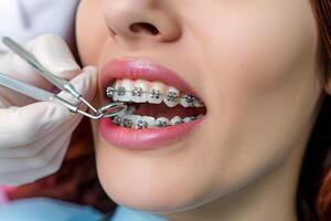 AI generated Orthodontist checking wire brace on woman teeth photo