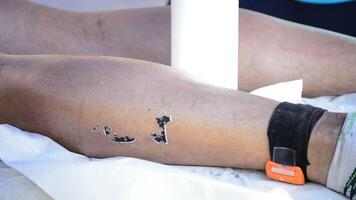 Physiotherapeut massieren Bein von ein Triathlet video