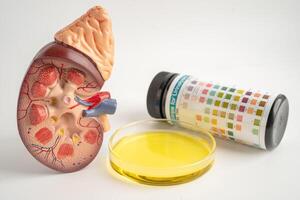 Urinalysis, Kidney model and urine cup with reagent strip pH paper test and comparison chart in laboratory. photo