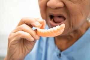 Asian elderly woman patient holding to use denture, healthy strong medical concept. photo