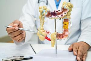 Intestine, appendix and digestive system, doctor holding anatomy model for study diagnosis and treatment in hospital. photo