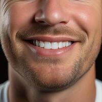 Close-up of snow-white and straight teeth of a young Caucasian man. photo