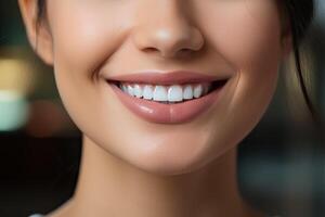 A perfect smile with white teeth of a young girl close-up. photo