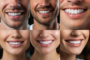 Set of men and women laughing and showing white teeth. photo