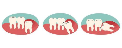 Wisdom teeth 2 cute on a white background, illustration. vector