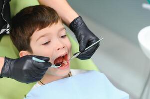 de cerca de pequeño chico apertura su boca durante dental chequeo foto