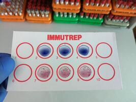 Widal test by agglutination method at plate isolated on black background, to diagnosis Typhoid and Paratyphoid fever at laboratory, Salmonella bacteria disease testing photo