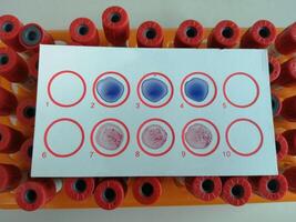 Widal test by agglutination method at plate isolated on black background, to diagnosis Typhoid and Paratyphoid fever at laboratory, Salmonella bacteria disease testing photo
