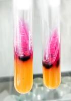 Salmonella detection method by using Triple Sugar Iron or TSI Agar in microbiology laboratory. photo