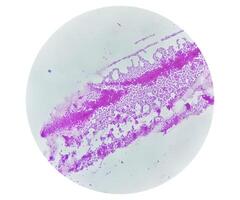 Pus gram stained microscopic showing gram positive bacteria. photo