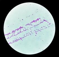 Pus gram stained microscopic showing gram positive bacteria. photo