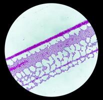 Pus gram stained microscopic showing gram positive bacteria. photo