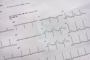 grafico demostración el resultados de el electrocardiograma prueba en grabación papel. foto