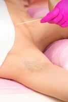 Hand in glove with spatula depilates female hairy armpit in a spa. photo