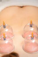 Young caucasian woman receiving cupping therapy in spa clinic. Islamic female medicine. photo