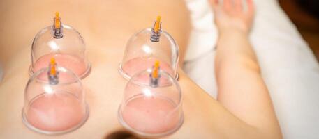 Young caucasian woman receiving cupping therapy in spa clinic. Islamic female medicine. photo