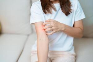 mujer Comezón y rascarse que produce picor brazo. sensible piel alérgico reacción a insecto morder, alimento, fármaco dermatitis. dermatología, lepra día, sistémico lupus eritematoso, alergia síntomas y erupción eczema foto