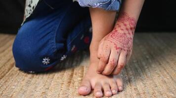 wenig Mädchen Leiden von Juckreiz Haut auf Füße video