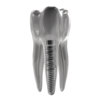 Rendered dental implant with screw and crown visible. png